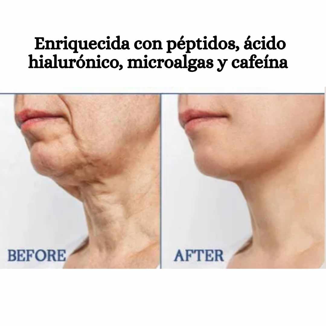 Crema Reafirmante HOYGI 100g – Efecto Lifting Sin Cirugía Ni Inyecciones