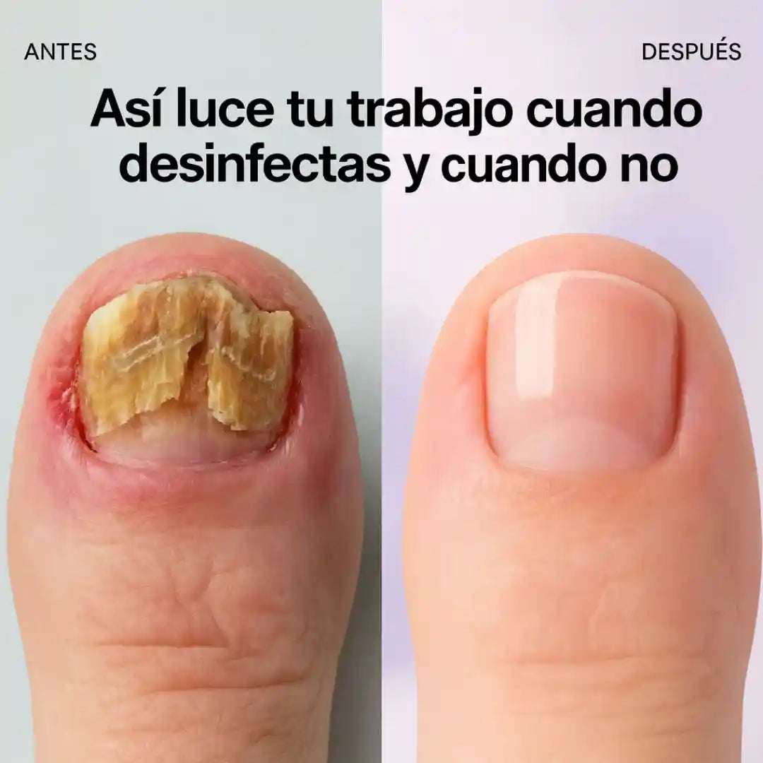 Cleany™ - Caja para Esterilizar Herramientas Fácilmente