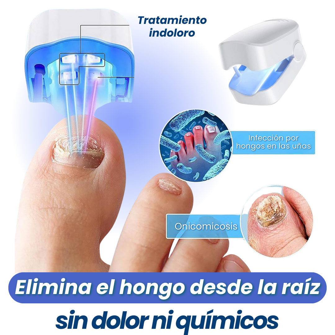 PodioLaser™ - El tratamiento definitivo con Luz Azul para eliminar los hongos