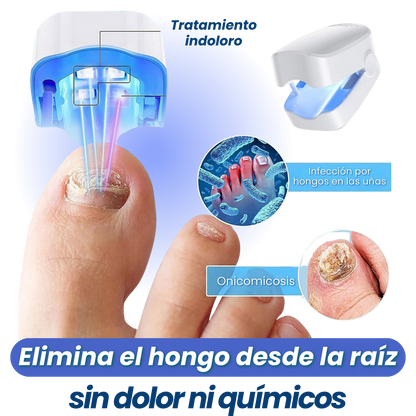 PodioLaser™ - El tratamiento definitivo con Luz Azul para eliminar los hongos