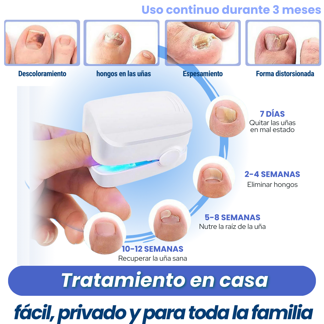 PodioLaser™ - El tratamiento definitivo con Luz Azul para eliminar los hongos
