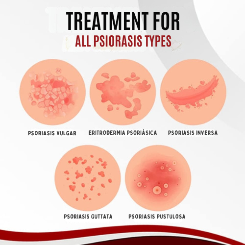 PielLibre™ 2x1 – Spray Anti-Psoriasis