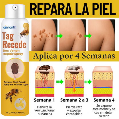 TagRecede™ - Solución Original Para Quitar Verrugas de Forma Sencilla